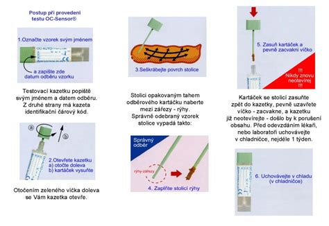 Infografika znázorňující postup kultivace stolice v laboratoři