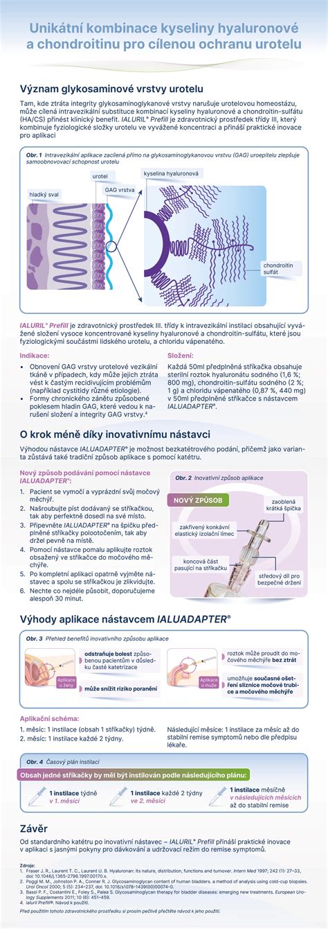 Infografika: SAE viskozita a kombinace zimní/letní tříd