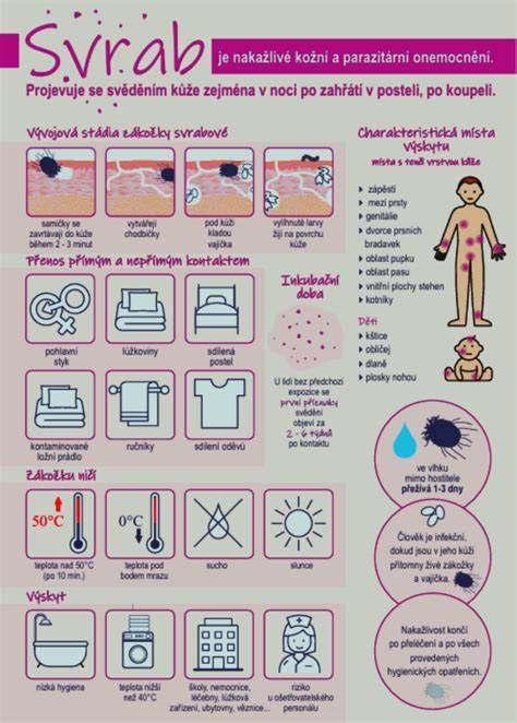 Infografika: Jak se projevuje vibrace při brzdění - přehled vlivu jednotlivých komponent na vibrace