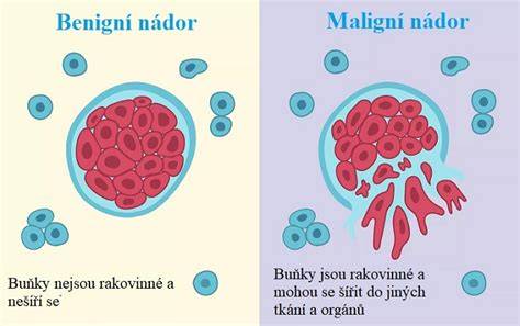 Infografika: Dělení agrese na benigní a maligní a jejich hlavní charakteristiky