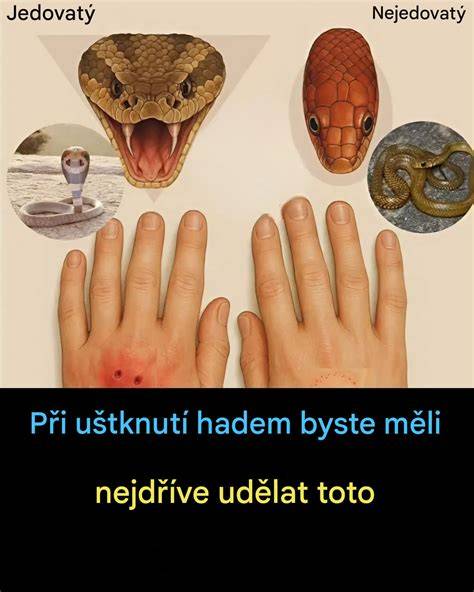 infografika: krok za krokem co dělat při nehodě