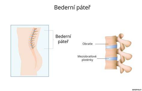 Infografika: bederní opěrka a rozložení tlaků na bederní páteř