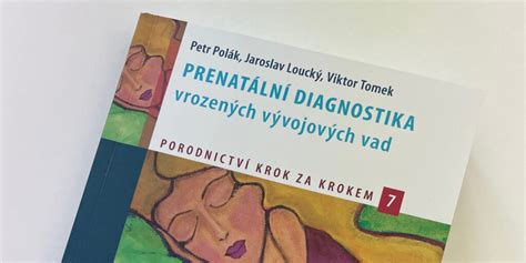 Infografika: Průběh diagnostiky DSG krok za krokem
