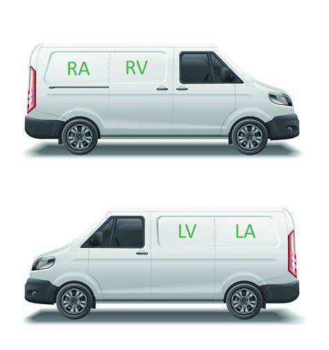 Infografika postupu demontáže ramen Citroën