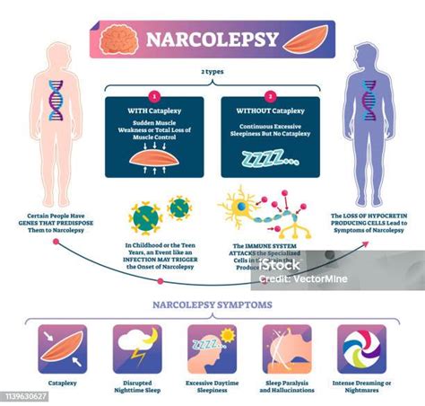infografika mechanismy sprinteřské síly
