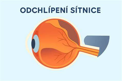 Infografika oční kamera a sítnice