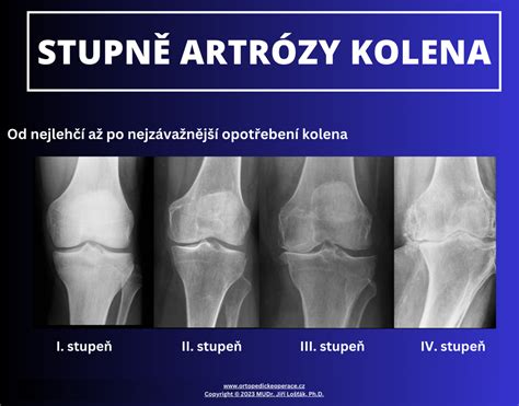 Koleno výfuku: ilustrace ukazující správné umístění kolena a jeho vliv na průchod plynu